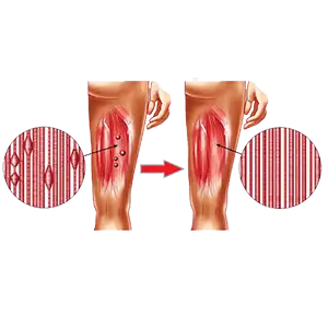 TRIGGER POINTS RELEASE