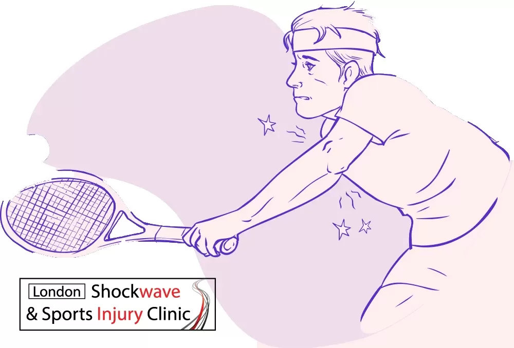 how doesn tennis elbow feel and do i have it - shock wave therapy wimbledon